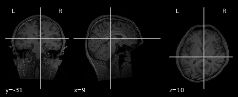 ../_images/6482cb9ad46f1ba556fc99a13b5ca8109c99d7a7acfd81b946ab5db746a81db0.png